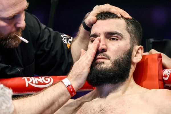 Артур Бетербиев следующий бой, срыв боя с Деоном Николсоном, расставание с промоутером, Top Rank